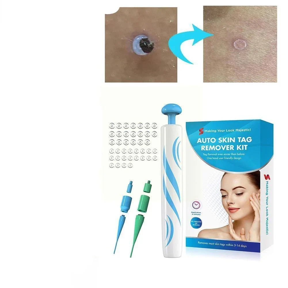Painless, DIY Device With Multiple Tips, TikTok Viral Fall 2026 Fast Removal – Skin Tag Remover Kit