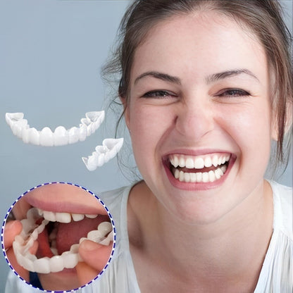 Veneers Smile Upper And Lower Instant Cover For All Day
