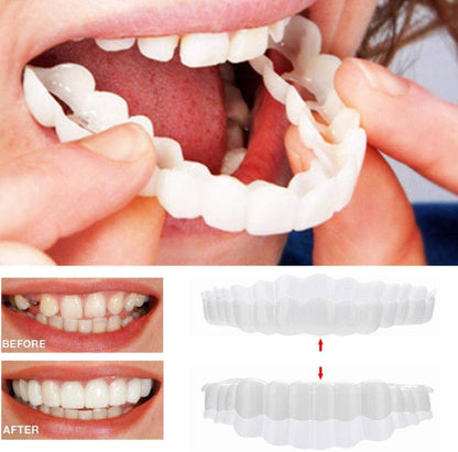 Veneers Smile Upper And Lower Instant Cover For All Day