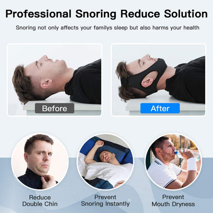 Anti2025 Edition Snoring Chin Strap Breathable Sleep Apnea Aid