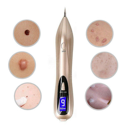 Mole Remover Pen At Household Skin Tag Removal Painless Fast