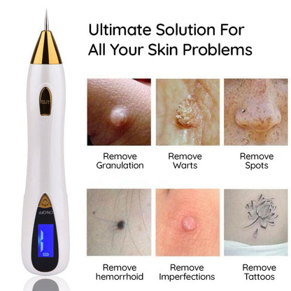 Mole Remover Pen At Household Skin Tag Removal Painless Fast