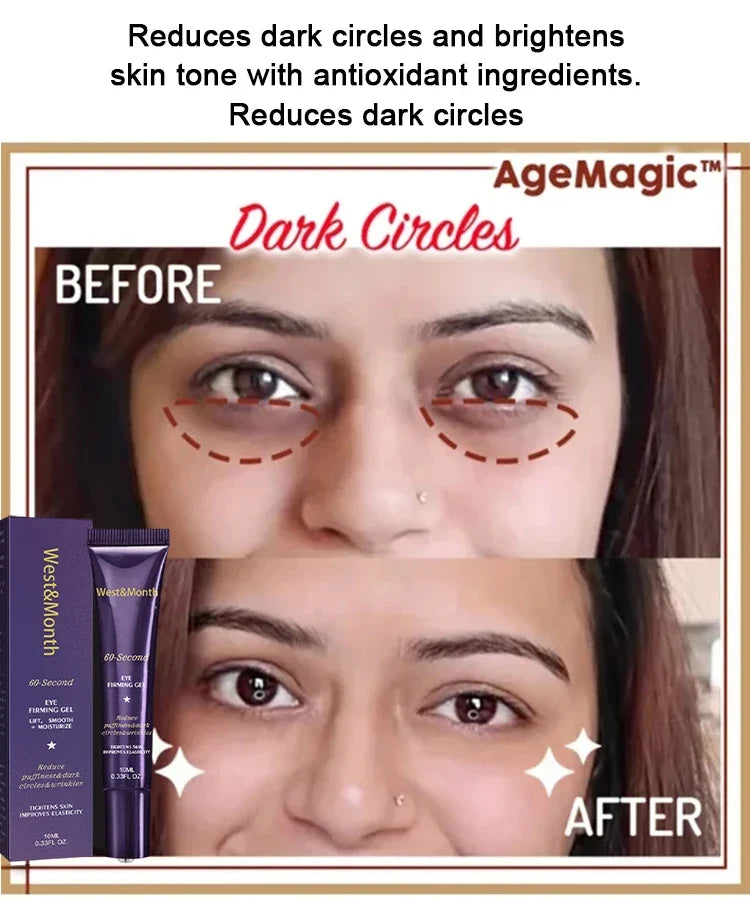 Anti-Wrinkle Firming Dark Circle Puffiness Eye Gel Skin Maintenance 2026 – Retinol Eye Bag Removal Cream