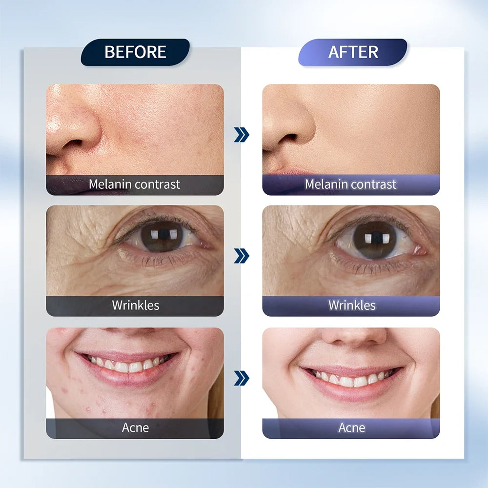 7-Color LED Photon Face Mask & Nano Spray Machine - Skin Rejuvenation Anti-Aging Household Therapy