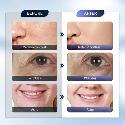 7-Color LED Photon Face Mask & Nano Spray Machine - Skin Rejuvenation Anti-Aging Household Therapy