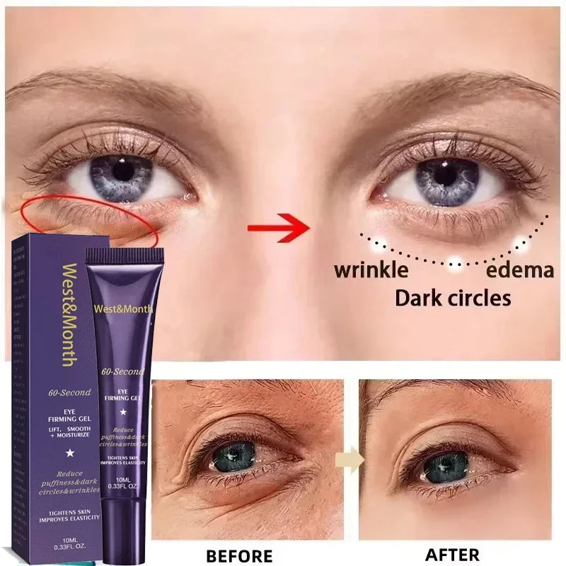 Anti-Wrinkle Firming Dark Circle Puffiness Eye Gel Skin Maintenance 2026 – Retinol Eye Bag Removal Cream