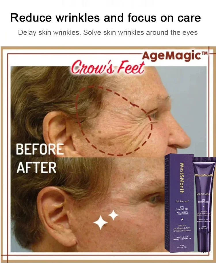 Anti-Wrinkle Firming Dark Circle Puffiness Eye Gel Skin Maintenance 2026 – Retinol Eye Bag Removal Cream