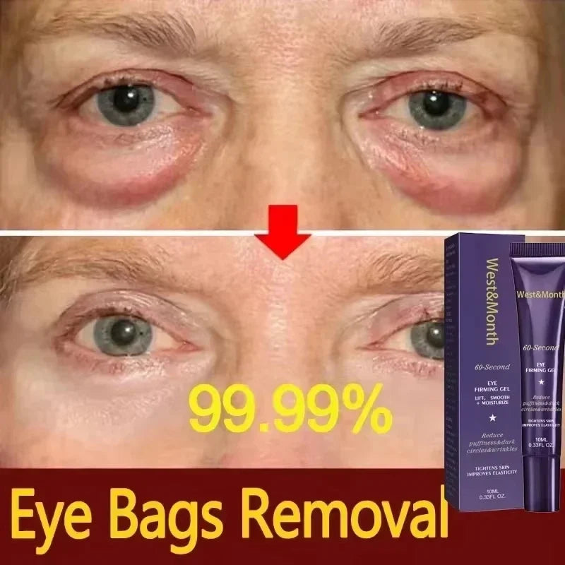 Anti-Wrinkle Firming Dark Circle Puffiness Eye Gel Skin Maintenance 2026 – Retinol Eye Bag Removal Cream