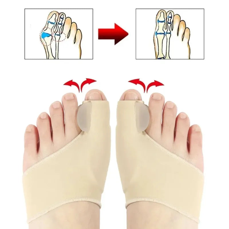 Orthopedic Foot Straightener Relief 2026 – Hallux Valgus Bunion Corrector Toe Separator Kit