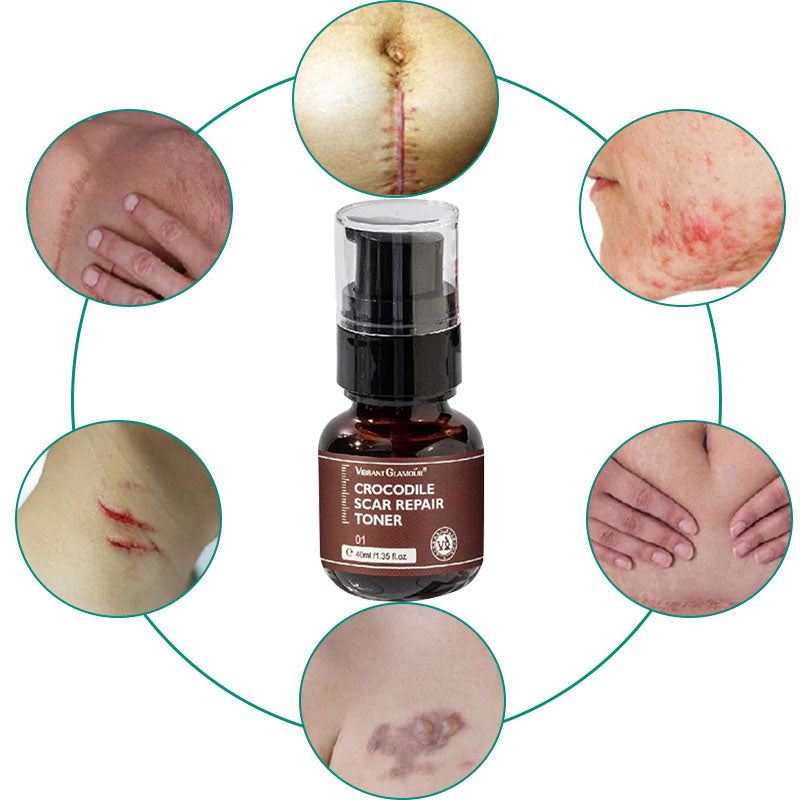 Repair Scar Toner Oil Free Vegan Skin Scar Reducer