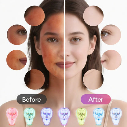 LED Face Mask 7-Color Cordless Photon Therapy Facial Neck Mask Winter 2025 Anti Aging Skin Tightening