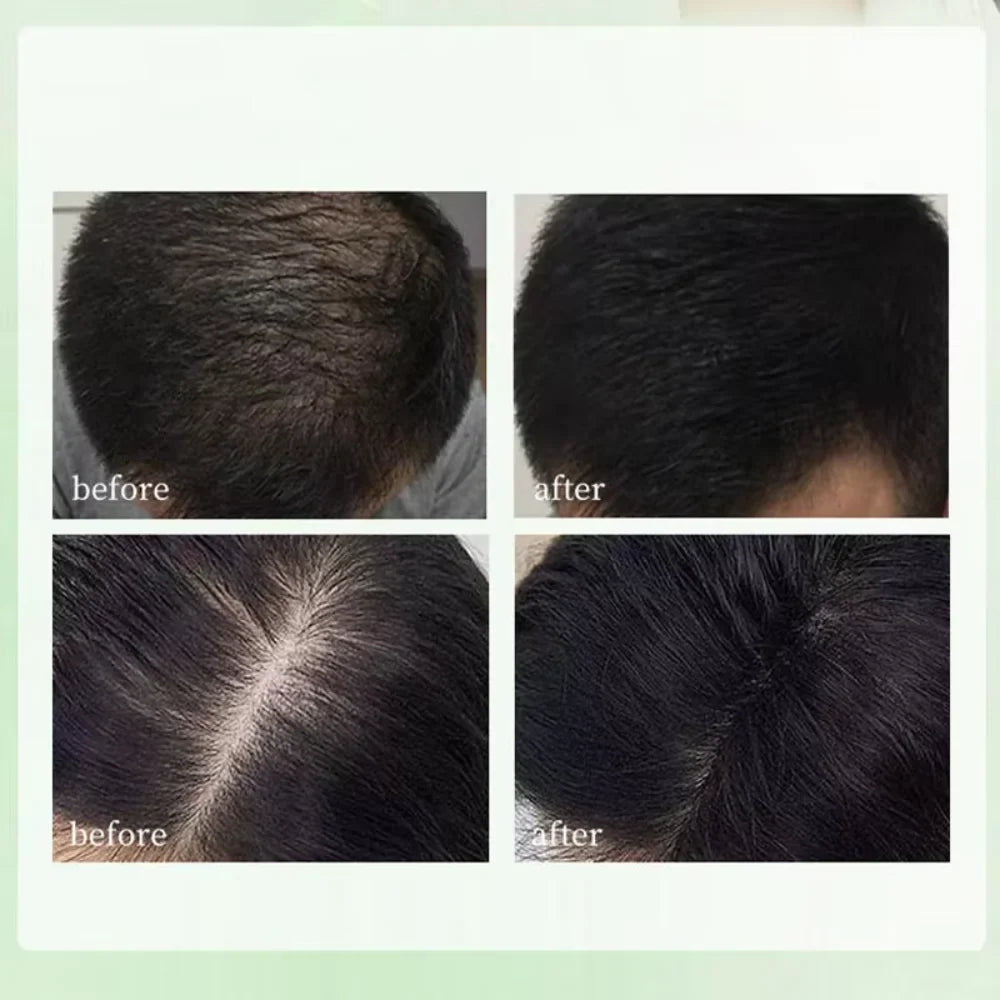 Herbal Shampoo Soap Handmade Hair Maintenance for All Hair Types Oil Control Refreshing Fall 2026 Trend