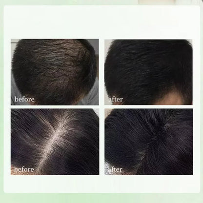 Herbal Shampoo Soap Handmade Hair Maintenance for All Hair Types Oil Control Refreshing Fall 2026 Trend