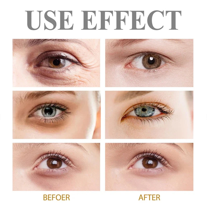 Anti-Wrinkle Firming Dark Circle Puffiness Eye Gel Skin Maintenance 2026 – Retinol Eye Bag Removal Cream