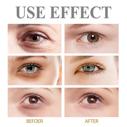 Anti-Wrinkle Firming Dark Circle Puffiness Eye Gel Skin Maintenance 2026 – Retinol Eye Bag Removal Cream