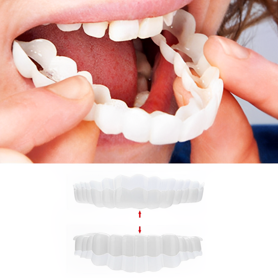 Veneers Smile Upper And Lower Instant Cover For All Day