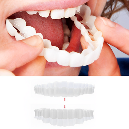 Veneers Smile Upper And Lower Instant Cover For All Day