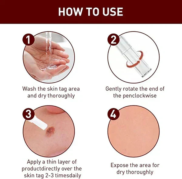 Skin Tag Mole Remover Pen With Tea Tree Oil Fast Household