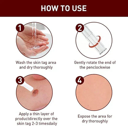 Skin Tag Mole Remover Pen With Tea Tree Oil Fast Household
